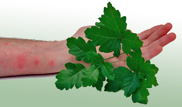 How To Prevent Poison Ivy From Spreading - Learn How To